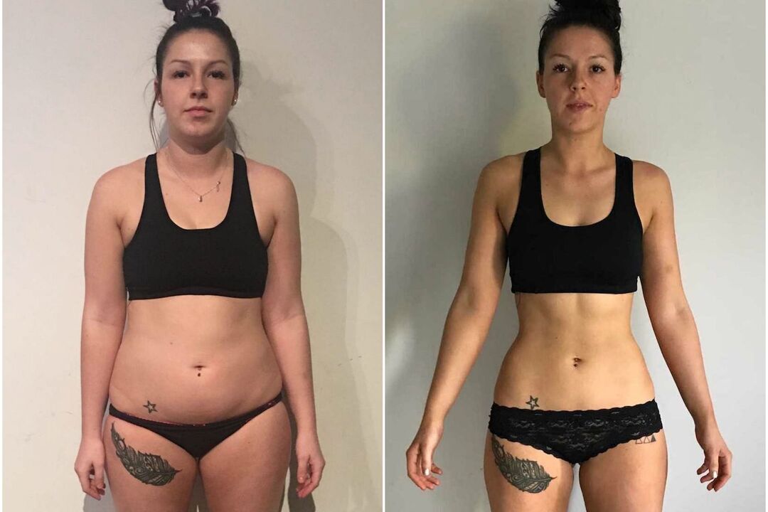antes y después de la pérdida de peso